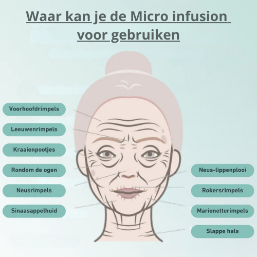 Tresiore infusion par micro-aiguilles